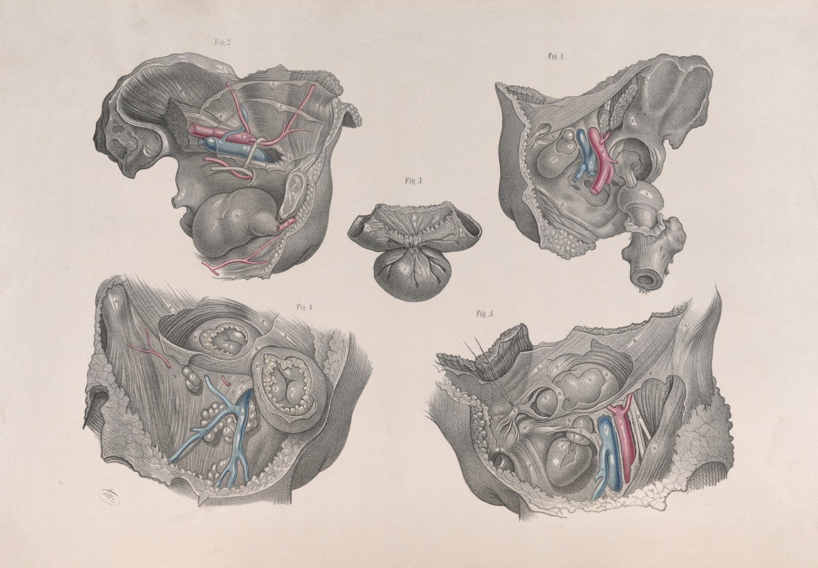 Joseph Maclise - Surgical anatomy Pl.36