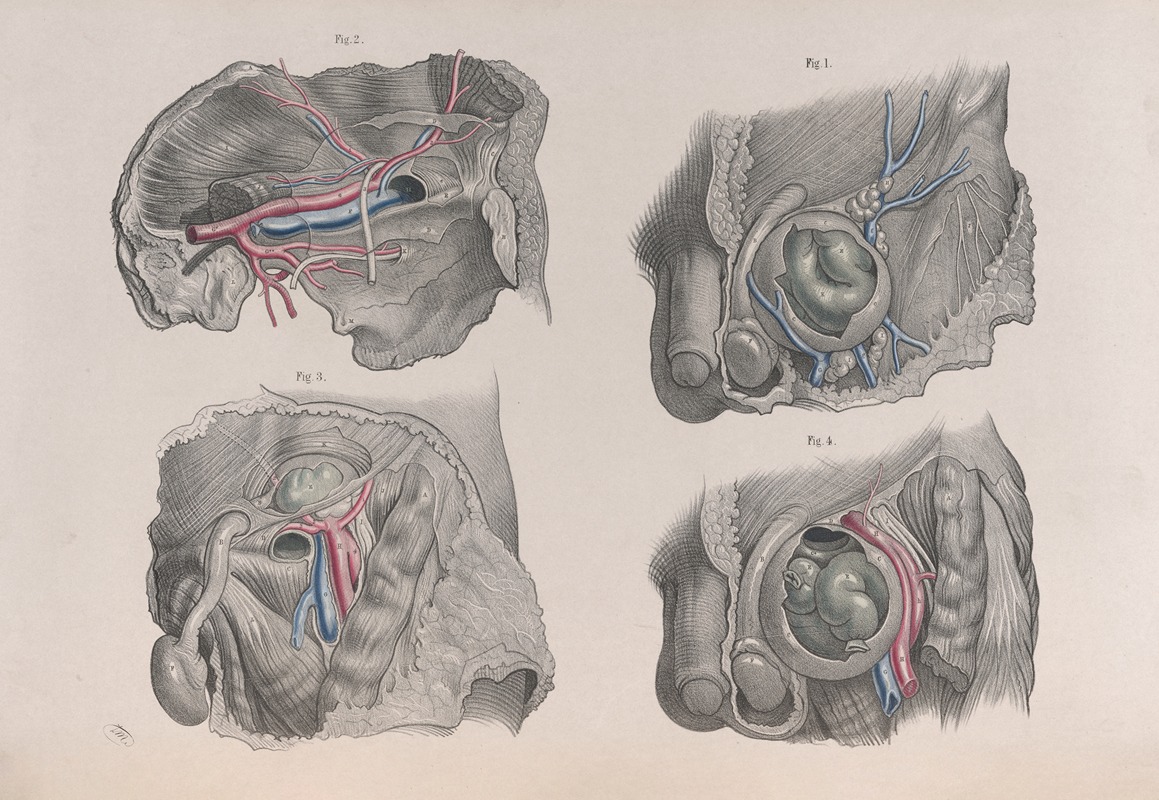 Joseph Maclise - Surgical anatomy Pl.37