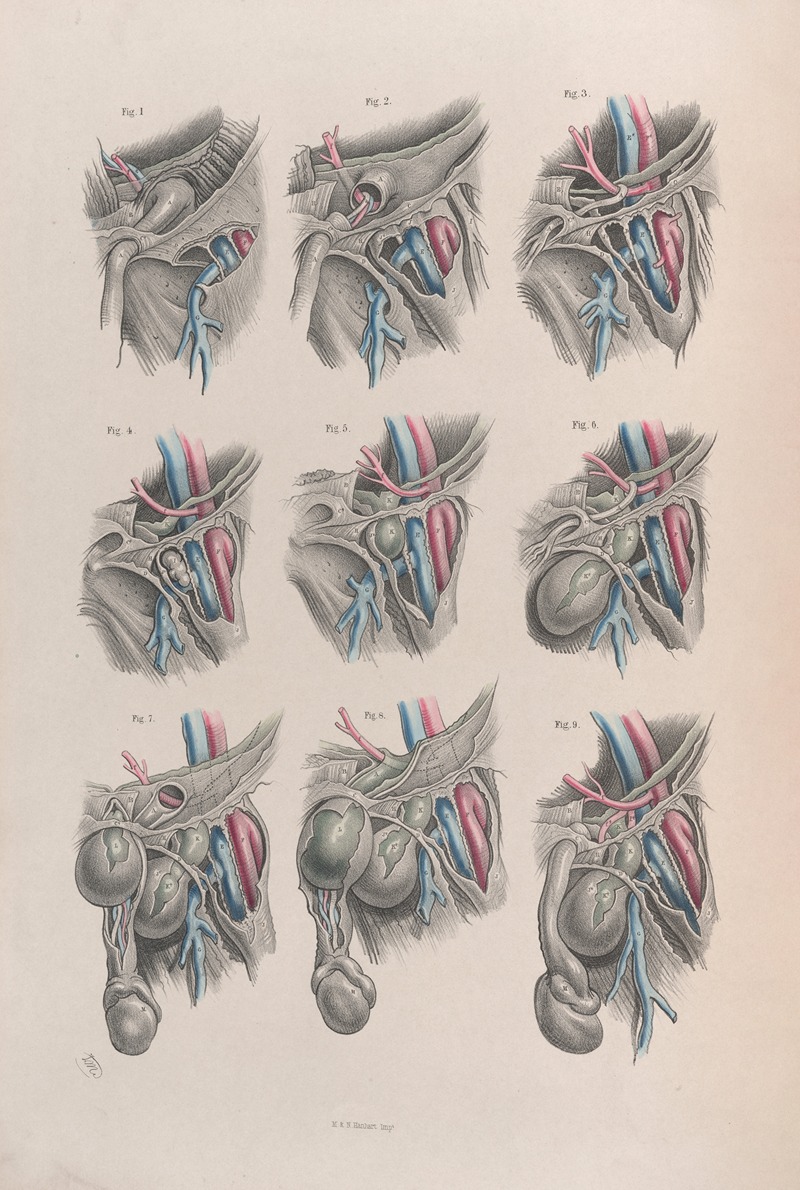 Joseph Maclise - Surgical anatomy Pl.38