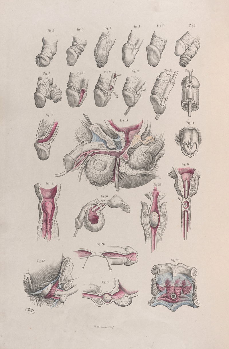 Joseph Maclise - Surgical anatomy Pl.44