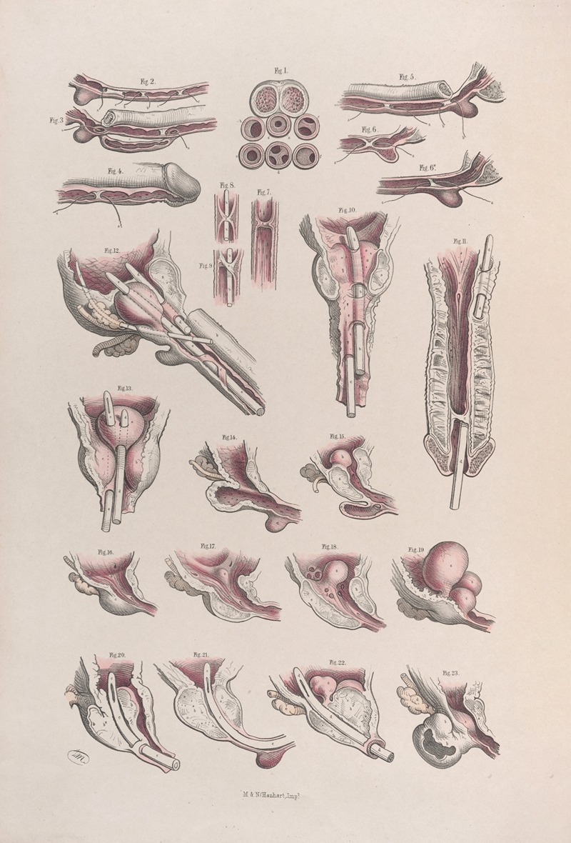 Joseph Maclise - Surgical anatomy Pl.45