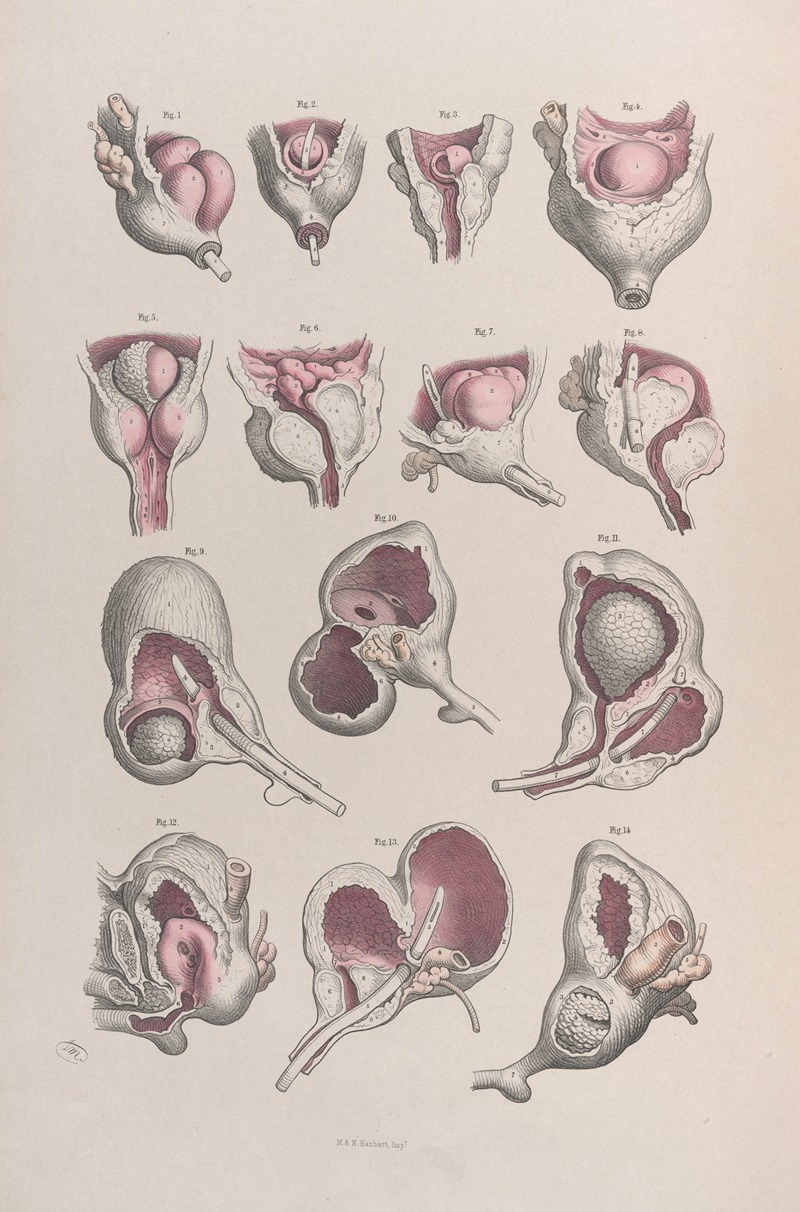 Joseph Maclise - Surgical anatomy Pl.46