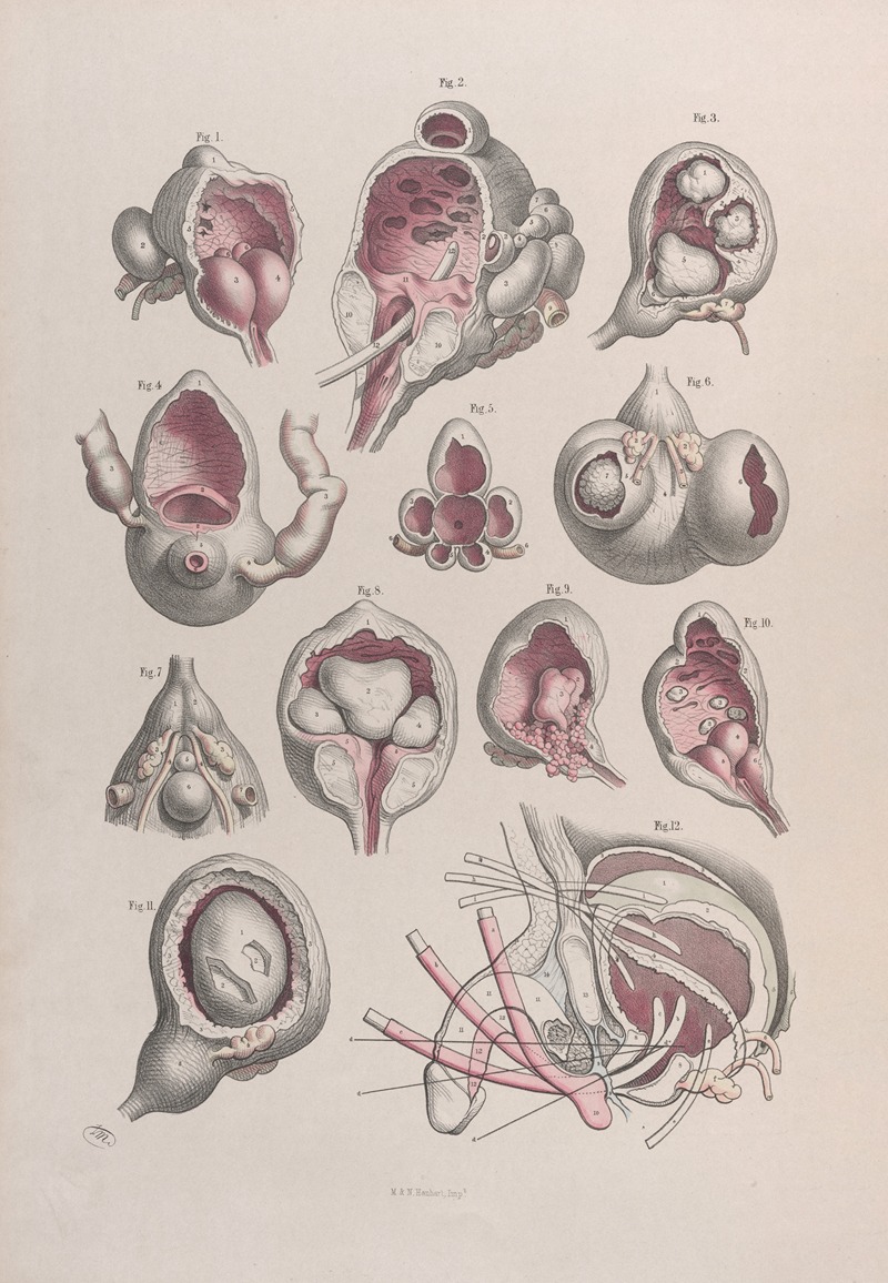 Joseph Maclise - Surgical anatomy Pl.47