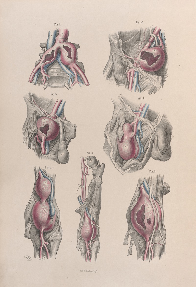 Joseph Maclise - Surgical anatomy Pl.52