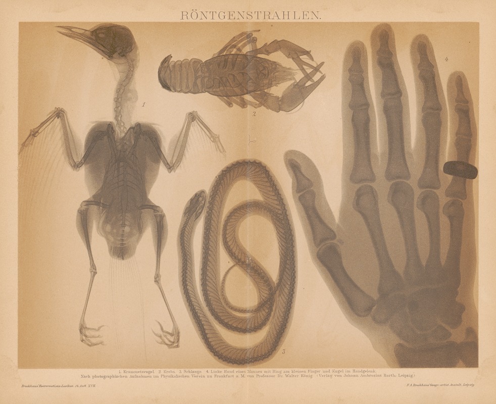 F.A. Brockhaus - Rontgenstrahlen